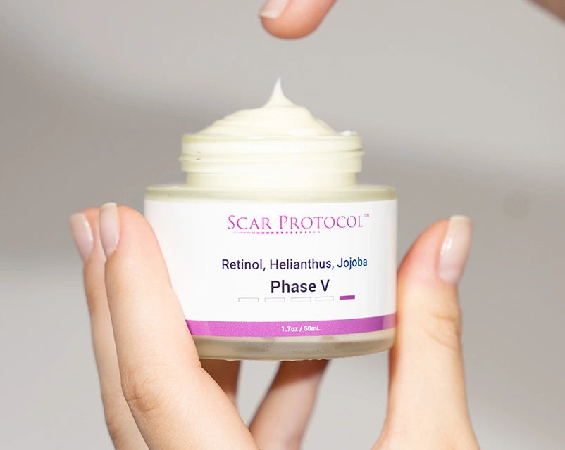 Phase V: ointment