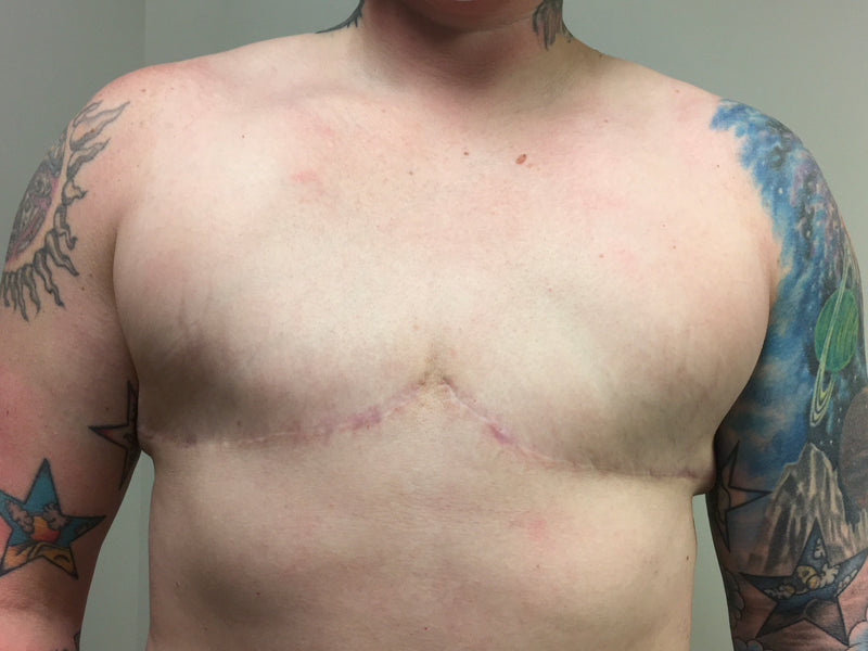 After photo