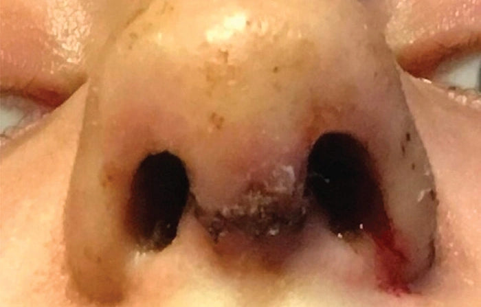 Before photo